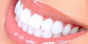 bright white smile Dr. Joe Thomas Dentistry